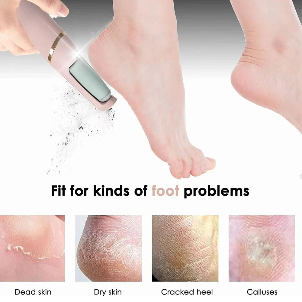 Electric Foot Grinder Callus Remover for Heels, Remove Hard Dead Skin and Calluses